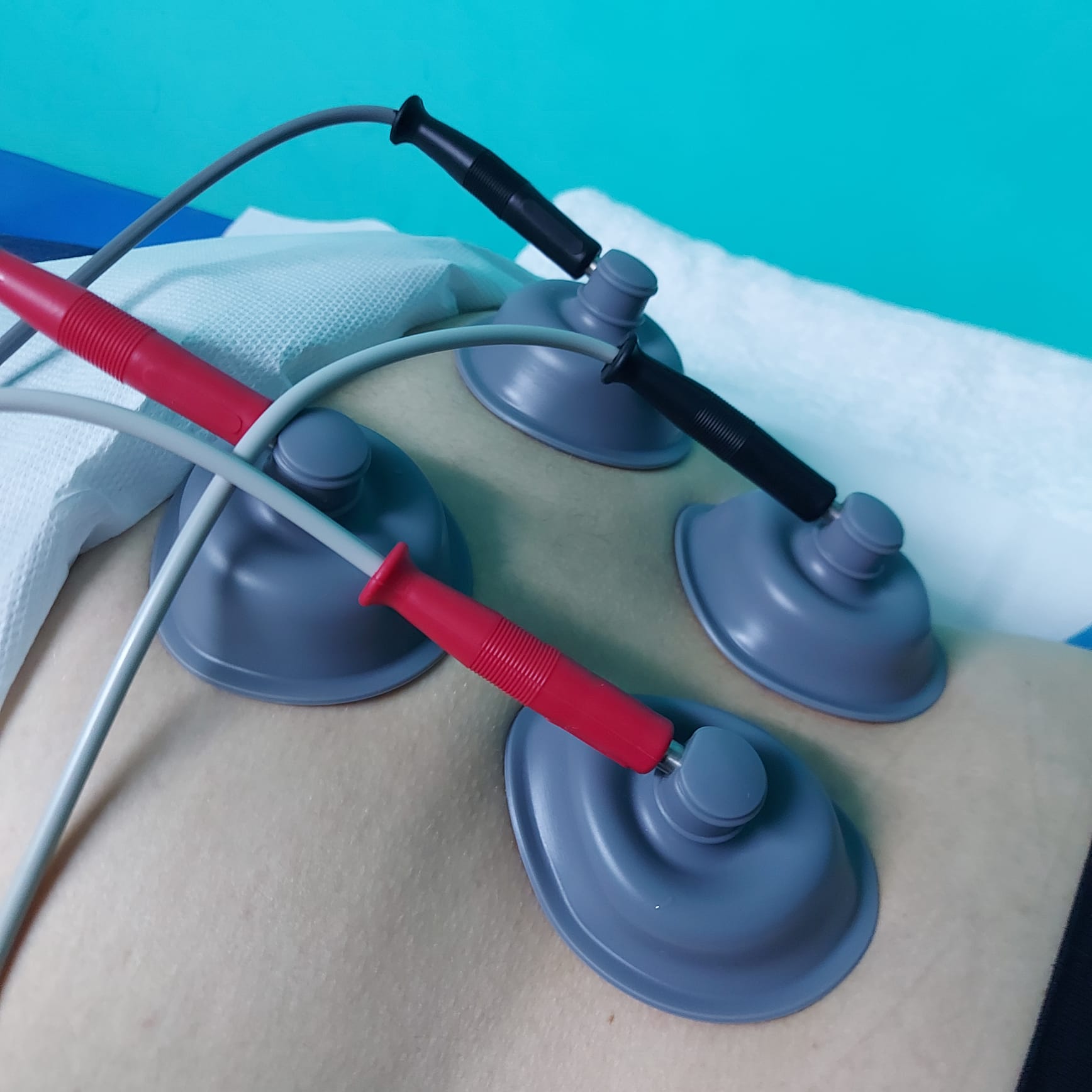 Echipament medical modern pentru fizioterapie