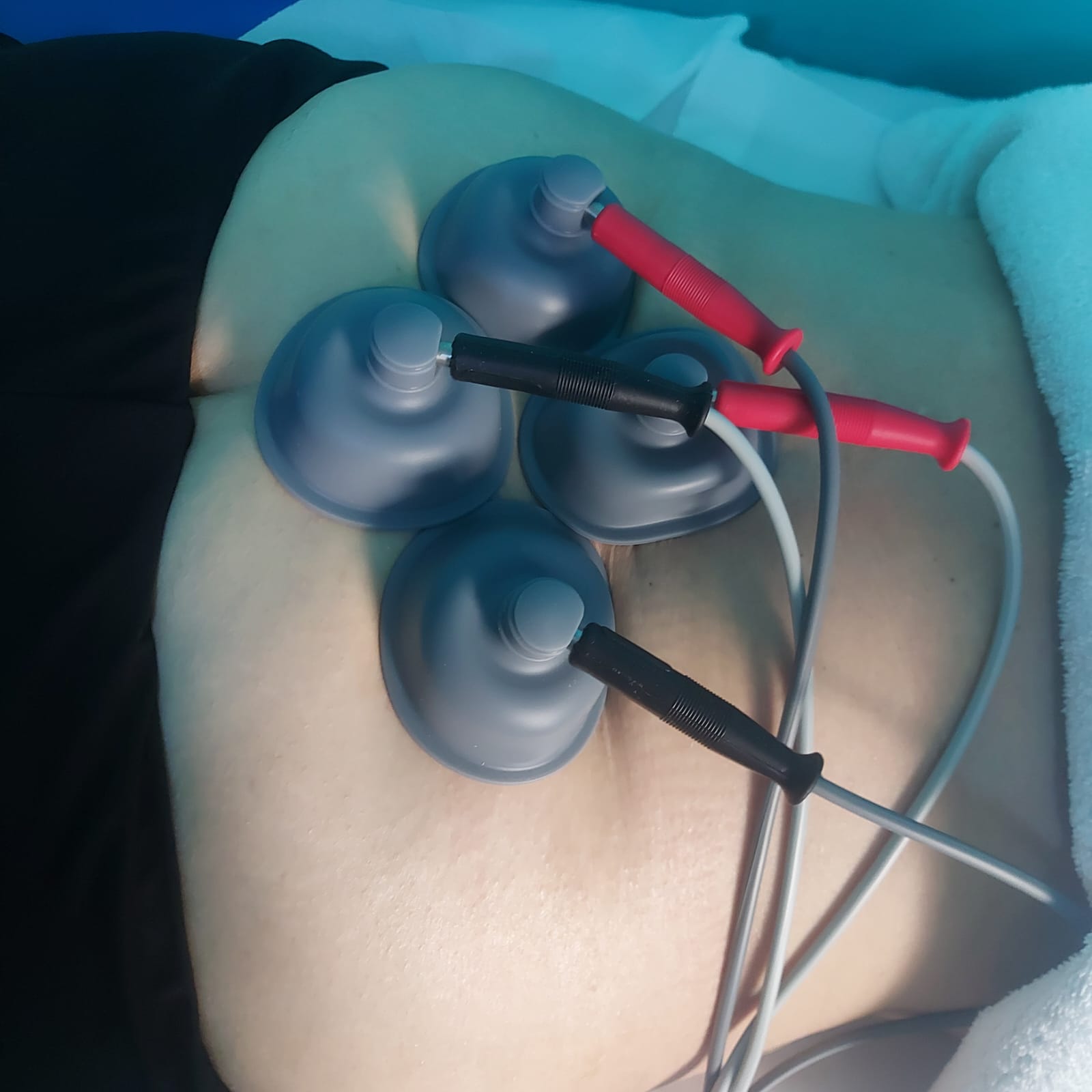 Aparat specializat pentru fizioterapie